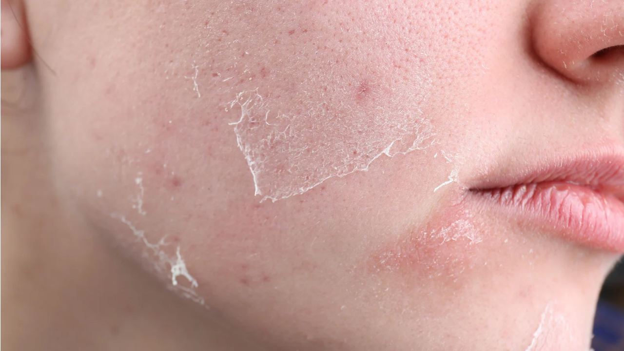 Tanda Facial Wash Tidak Cocok dengan Kulit dan Cara Memilih yang Tepat